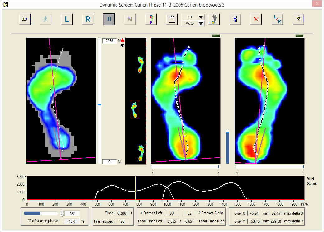 Pressure measurement screenshot